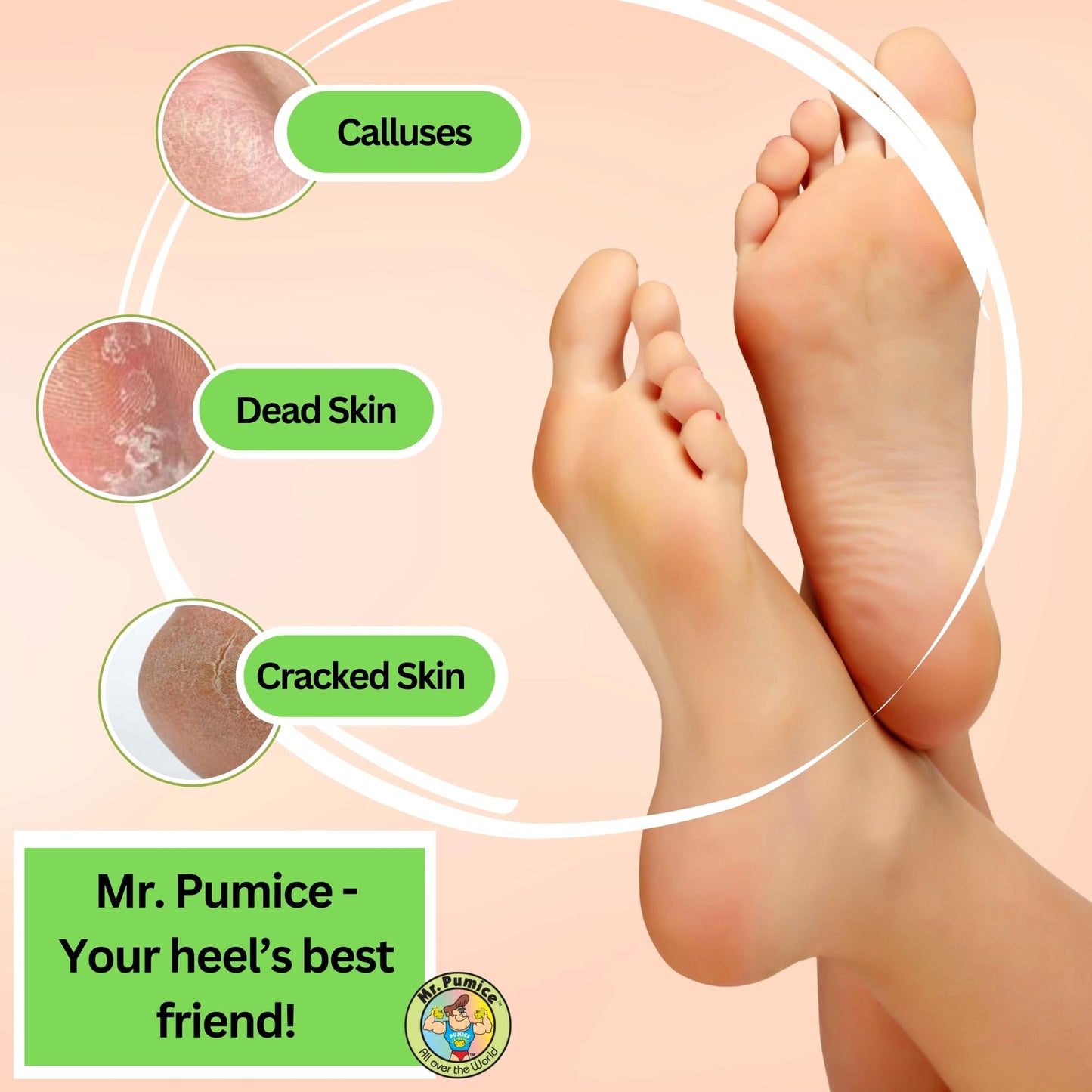 Mr. Pumice Callus Remover PUMI Bar: Pedicure Stone & Foot/Heel Scrubber - Medium Grit (Assorted Colors) 4 Pack