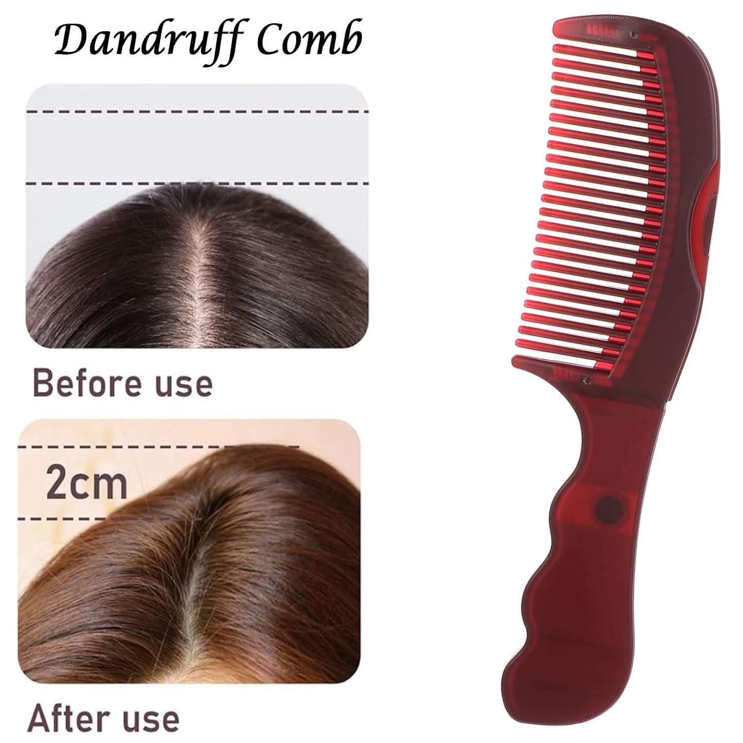 Dandruff Comb for Scalp Care - Multifunctional Hairbrush for Dandruff Removal, Detox & Psoriasis, Lice Comb with Hollow Tooth Design, Scalp Massage Brush for Men, Women & Kids(Red)