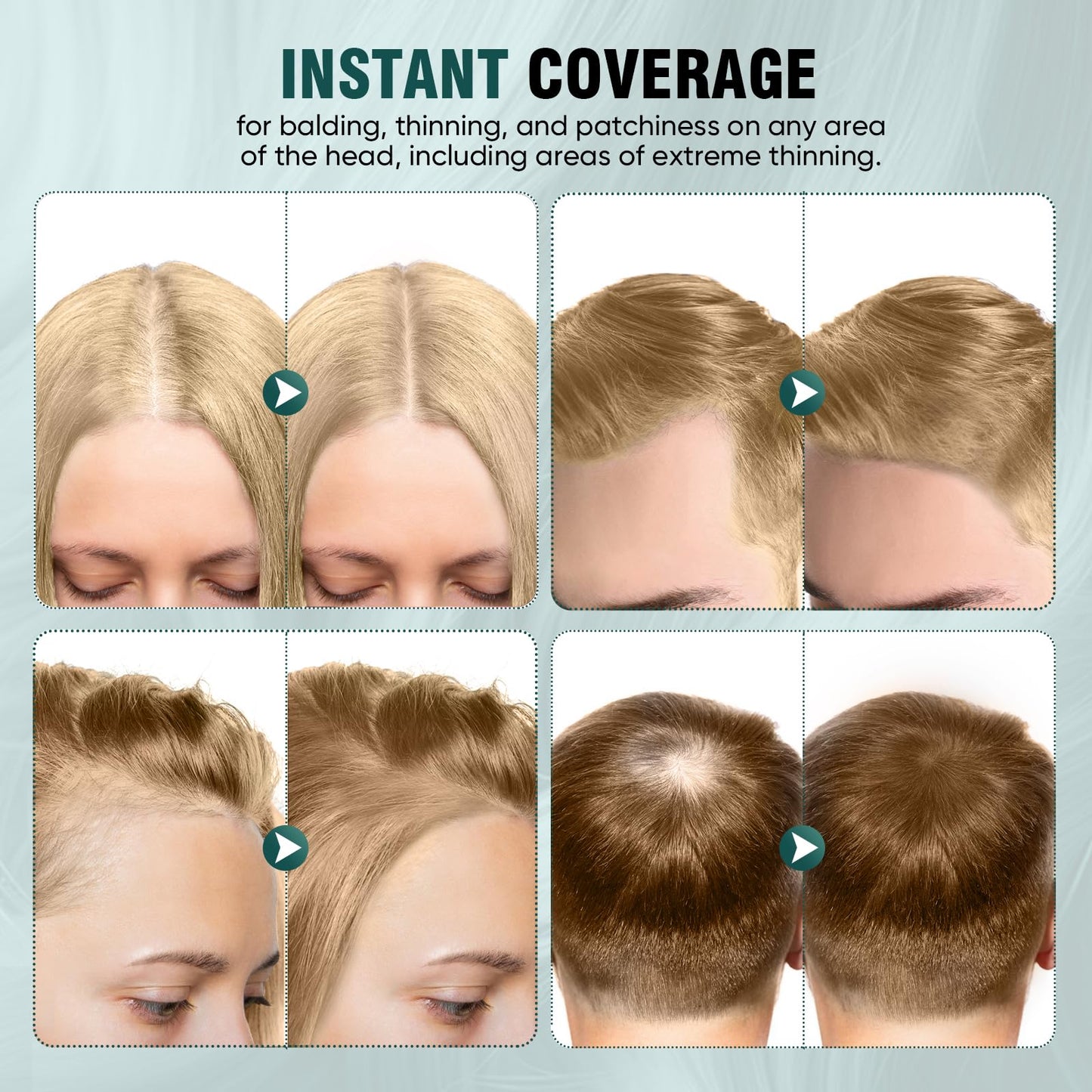 Farndu Hairline Powder 12g, Instantly Hair Root Touch Up, Hair Color Powder, Bald Spots Hair Color Concealer for Women & Men, 24-Hour Stain-Proof, Includes 2 Refills, for Thinning Hair, Light Blonde