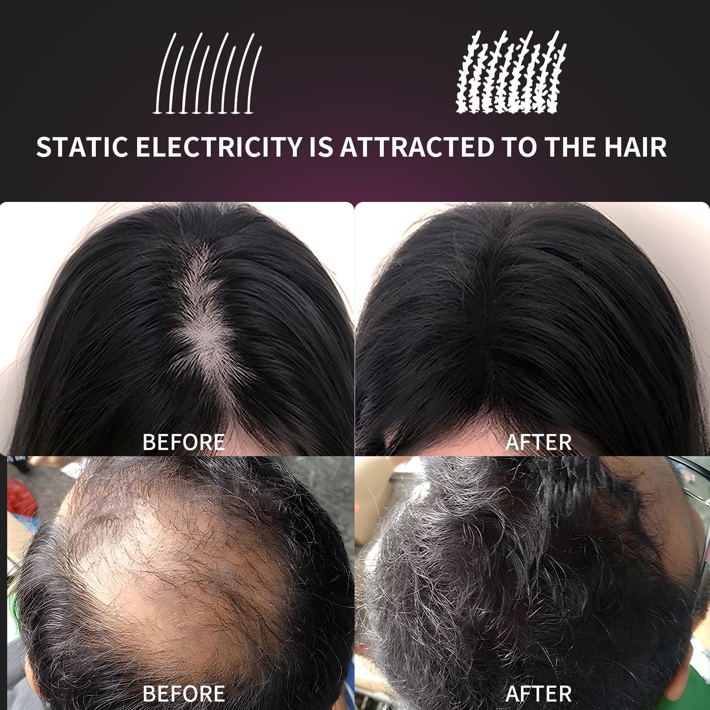 SEVICH Hair Fibers for Thinning Hair, Hair Building Fibers Instantly Thicker & Fuller Look,Hair Powder for Men & Women 25g Blonde